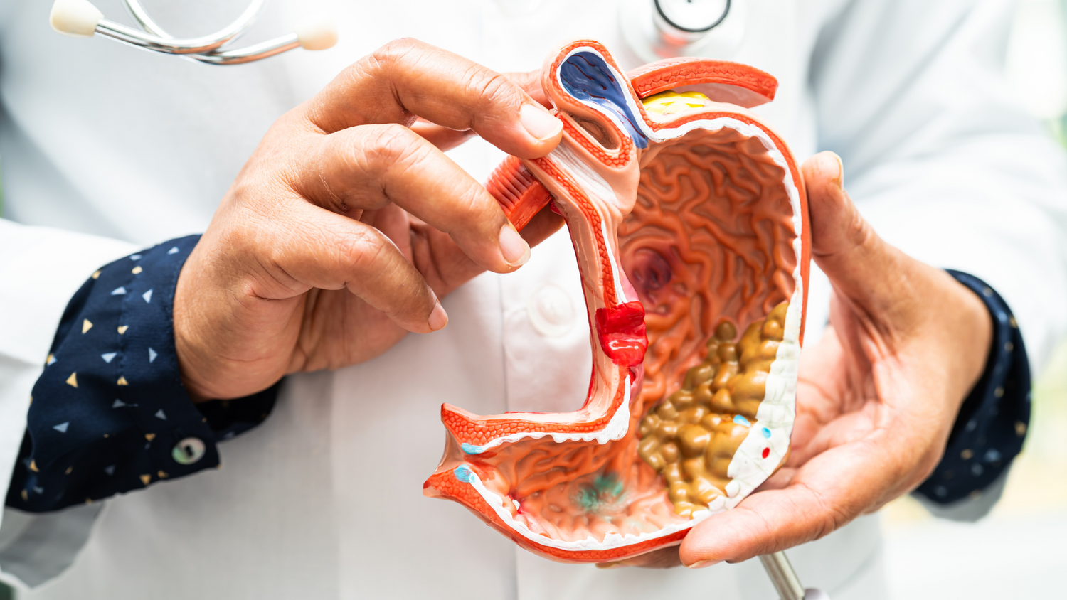 The Role of Gut Microbiota in Digestive Health: Tips for Maintaining a Healthy Gut