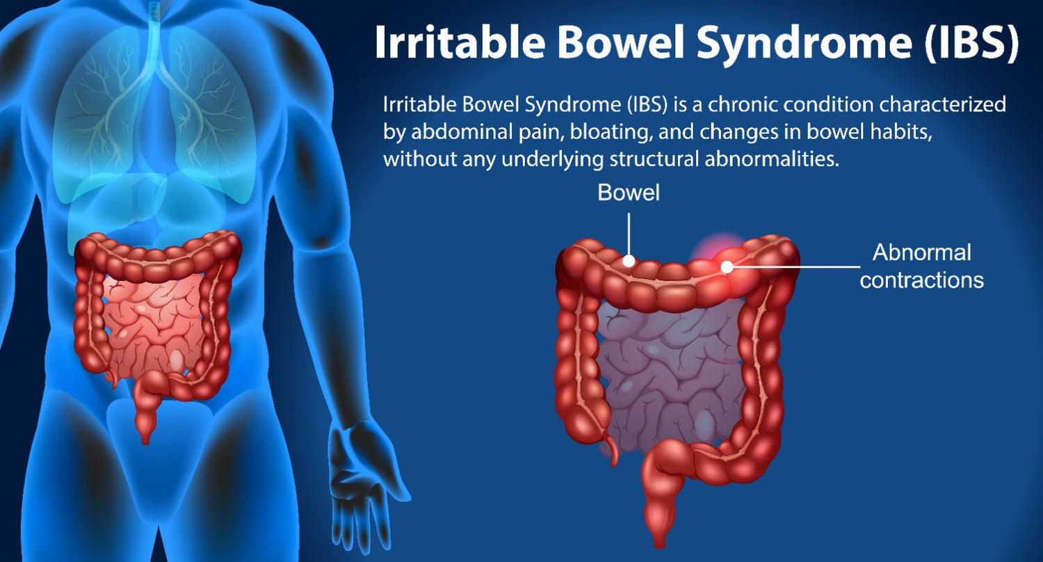 Irritable bowel syndrome explained