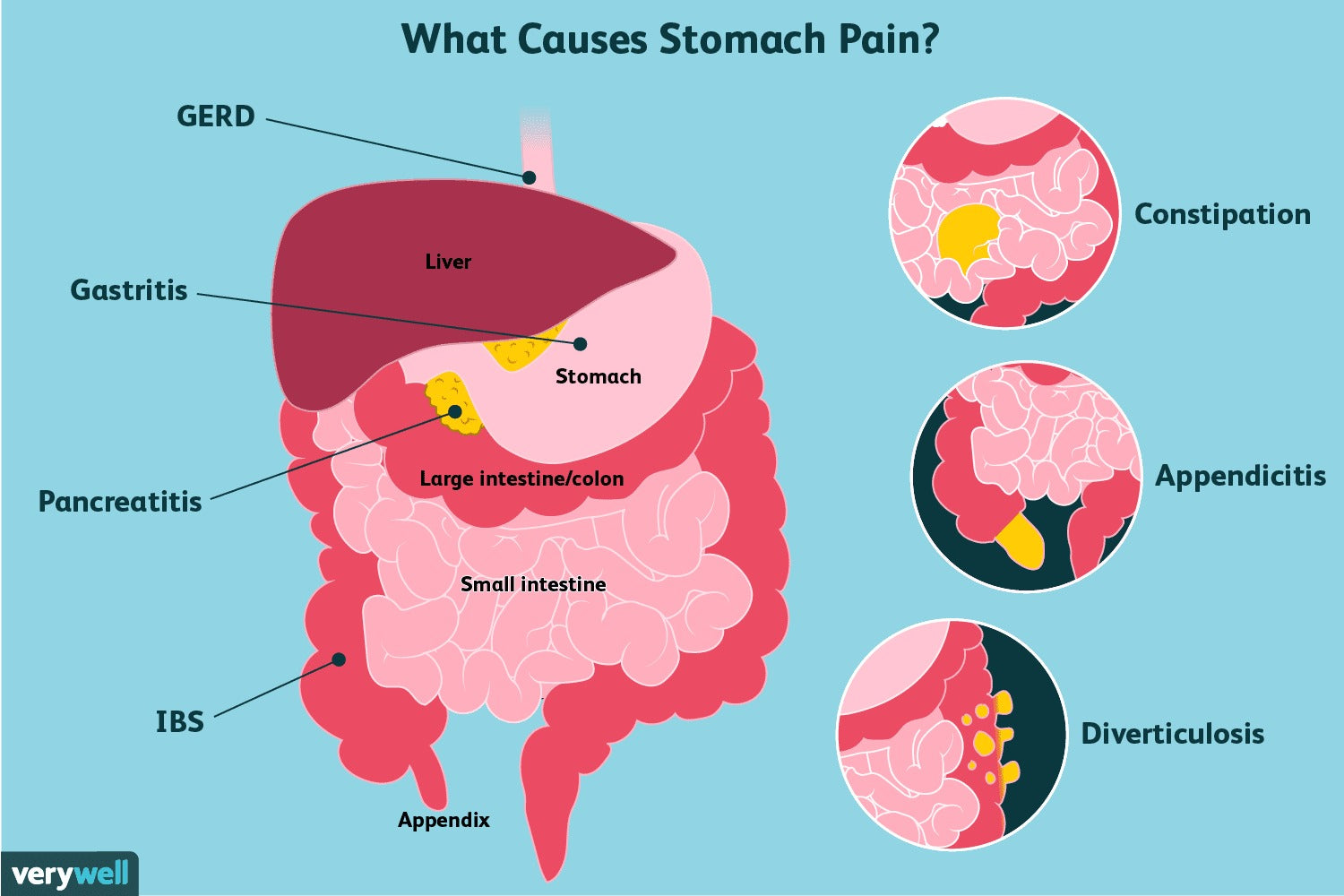 Explained the stomach pain reason