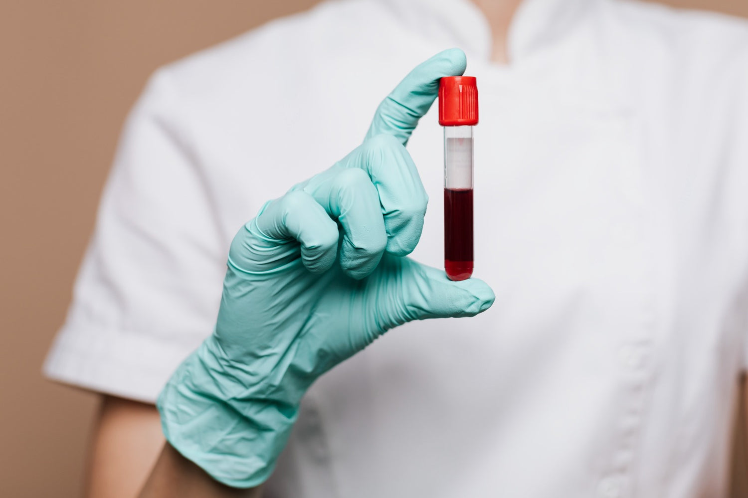 nurse holding blood test tube