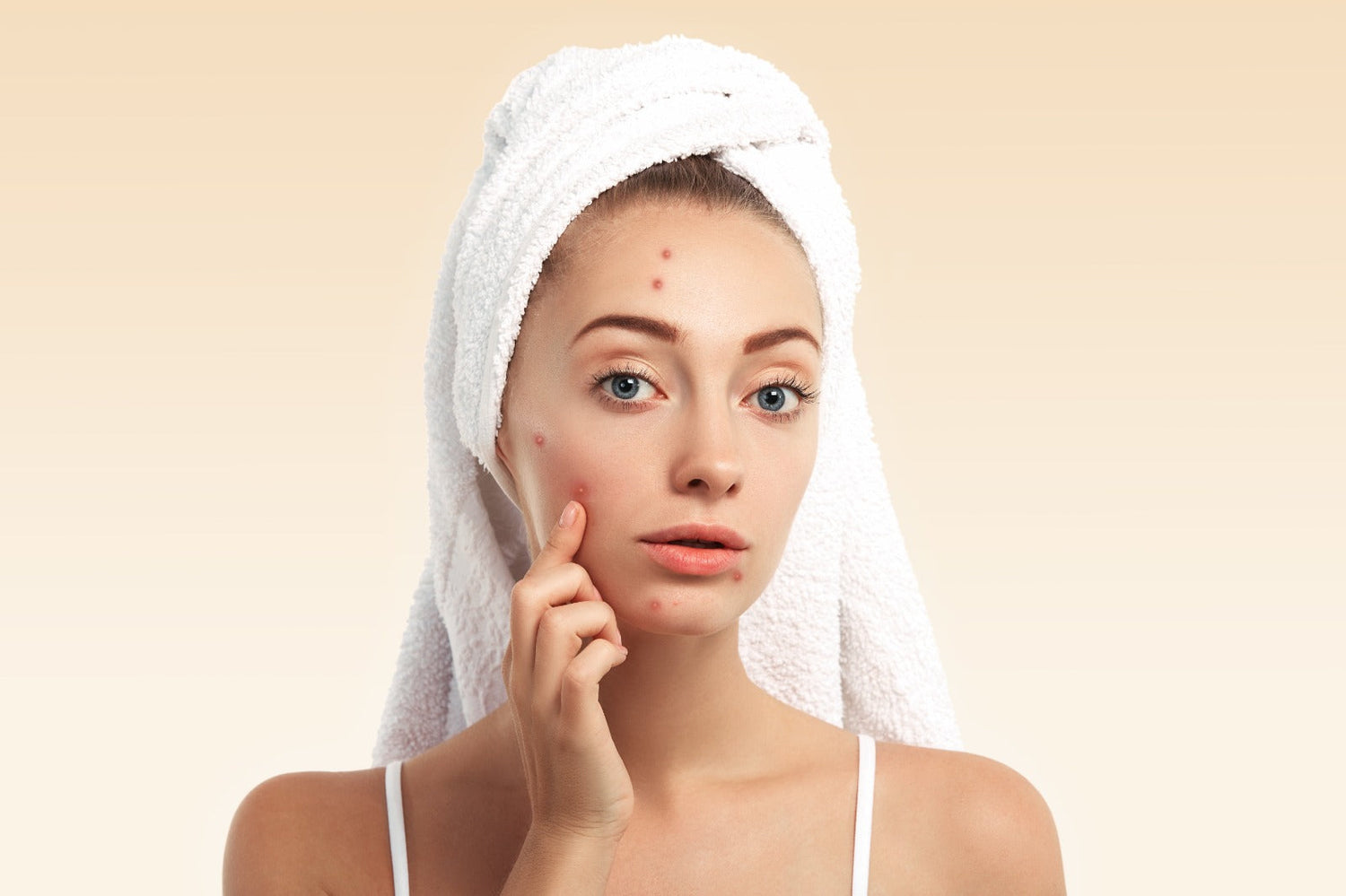 Why Is Your Skin Breaking Out? Understanding And Treating Pimples On Your Cheeks