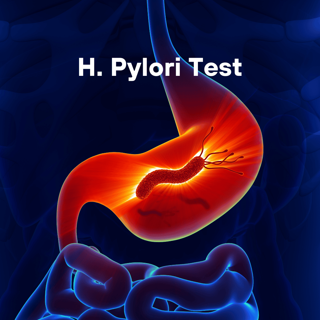 Helicobacter Pylori (H. Pylori) Infection Test